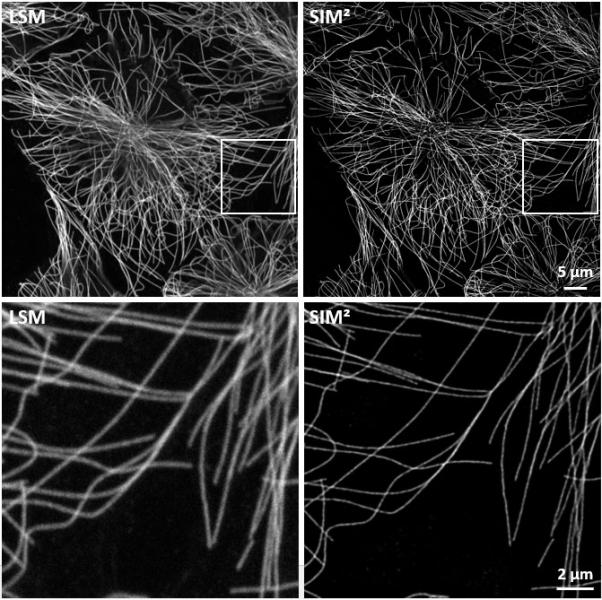 Ein Vergleich einer Lattice SIM² Aufnahme mit einem konfokalen Bild. Das Bild zeigt 1. Auflösungsteigerung bei SIM² und 2. Besseres Sectioning bei SIM², Bild: Carl Zeiss Microscopy