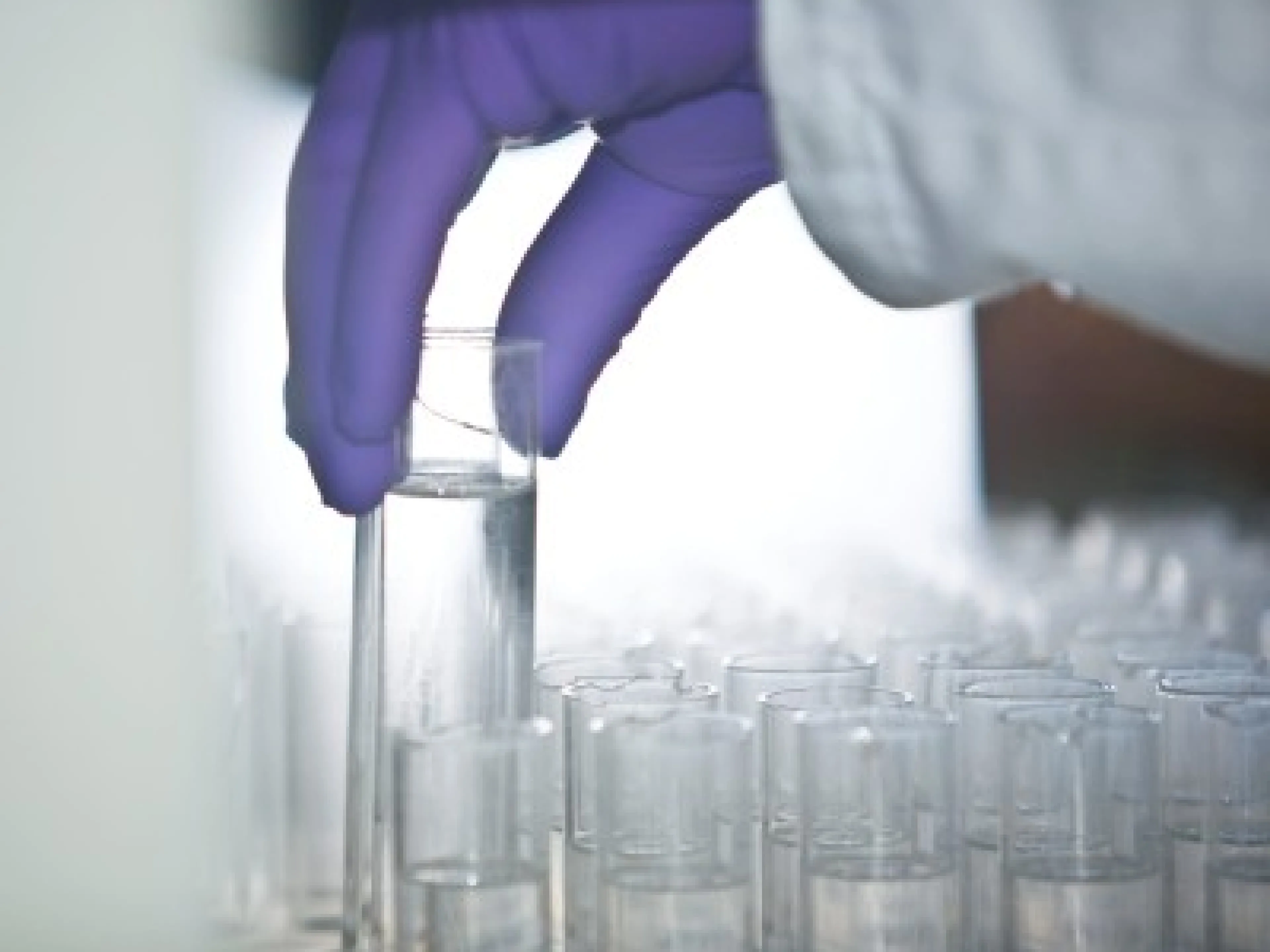 Roche übernimmt Kapa Biosystems